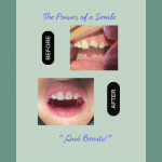 The Power of a Smile