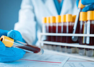 Blood getting tested in a lab