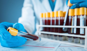 Blood getting tested in a lab